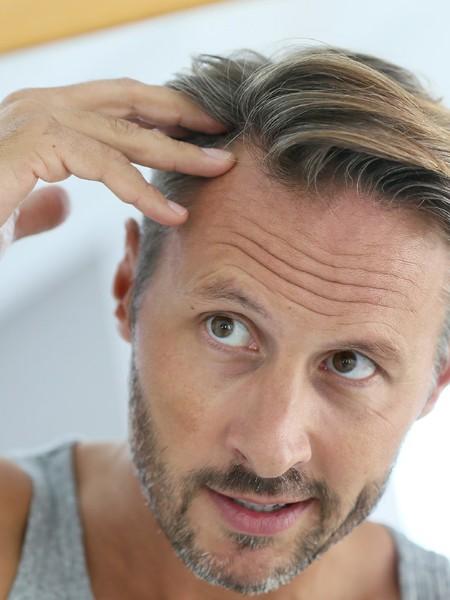 implant cheveux implant cheveux