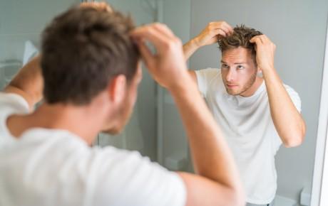 Perte de cheveux ou alopécie ? Un test génétique est disponible : le Trichotest®